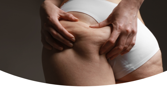Tratamento para celulite